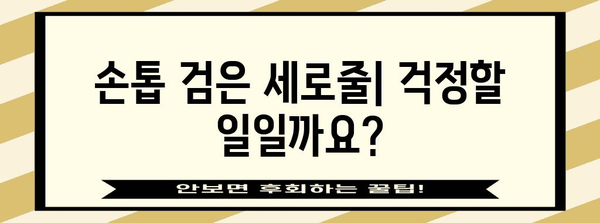 손톱 검은 세로줄의 원인과 대처법 밝히기